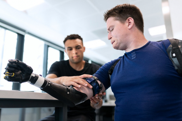 Mechanical engineer fits a prosthetic arm to a patient.